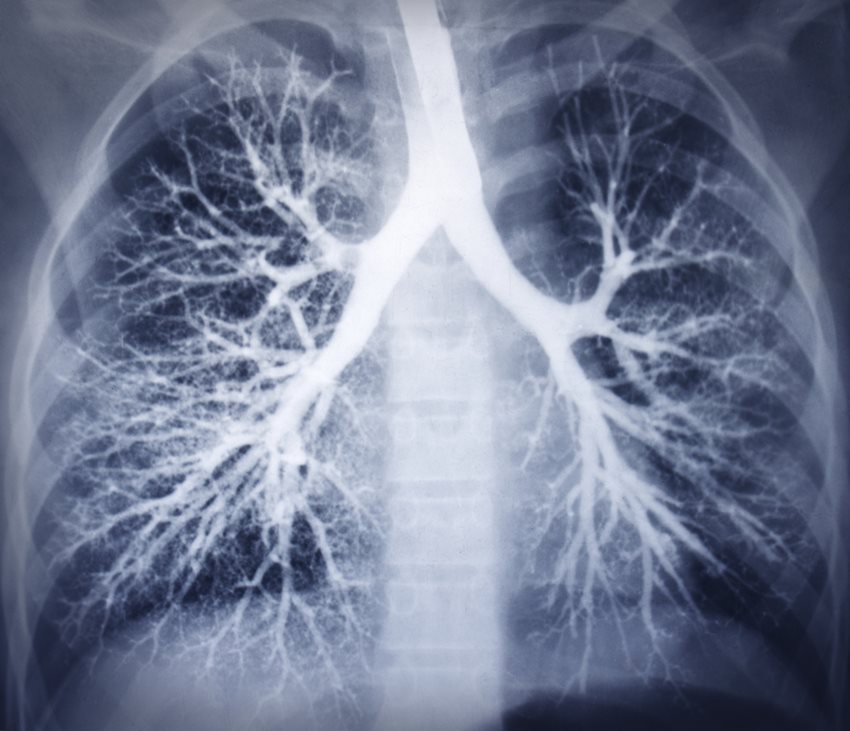 Terapia światłem Bioptron Hyperlight w walce z panującą na całym świecie infekcją wirusową… Terapia światłem Bioptron Hyperlight w walce z panującą na całym świecie infekcją wirusową…
